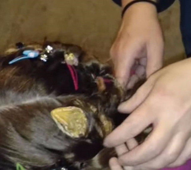 Foto - Küçük kızın kafasından çıkan şey aileyi şoka soktu!