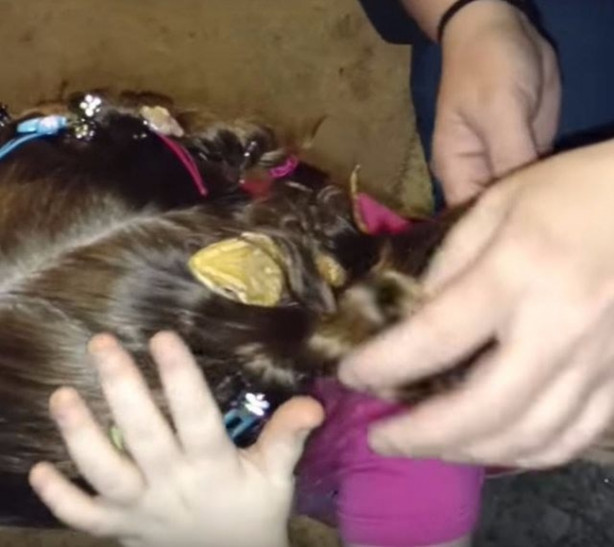 Foto - Küçük kızın kafasından çıkan şey aileyi şoka soktu!