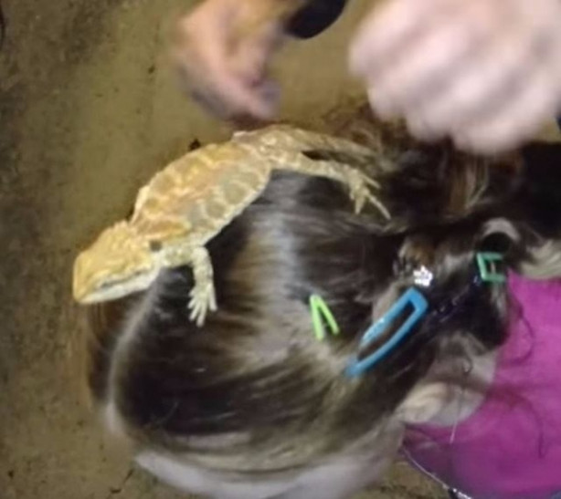 Foto - Küçük kızın kafasından çıkan şey aileyi şoka soktu!