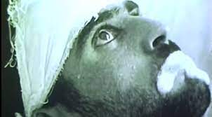 Foto - Kuduz hastalığı nedir, hayvanda - insanda kuduz belirtileri nelerdir? (Kediden) insandan insana kuduz nasıl bulaşır? Kaç günde içinde ortaya çıkar? Tedavisi var mı?