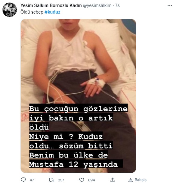 Foto - Kuduz olan küçük Mustafa, hayatını kaybetti! Sosyal medya ayağa kalktı! Hükümet, bakanlar, valilik ve belediye kamuoyundaki infiale hala sessiz!