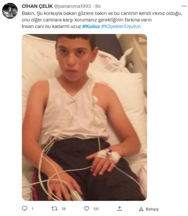 Foto - Kuduz olan küçük Mustafa, hayatını kaybetti! Sosyal medya ayağa kalktı! Hükümet, bakanlar, valilik ve belediye kamuoyundaki infiale hala sessiz!