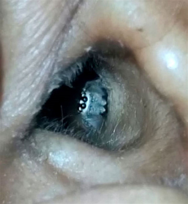 Foto - Kulağından çıkanı görünce şok oldu!