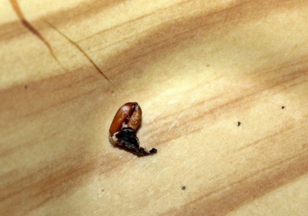 Foto - Kulağından öyle bir şey çıktı ki, herkes şok oldu!