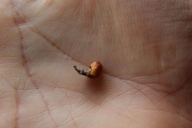  Kulağından öyle bir şey çıktı ki, herkes şok oldu!