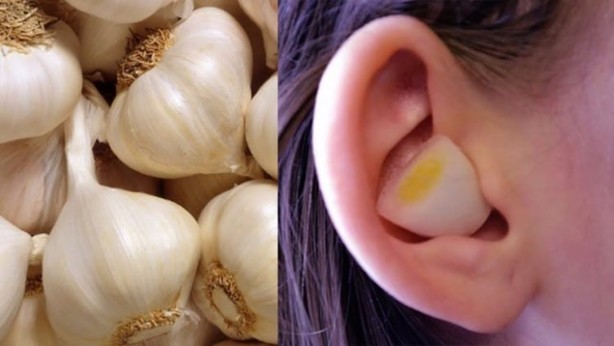 Kulağınıza sarımsak sokup bekletirseniz bakın ne olur
