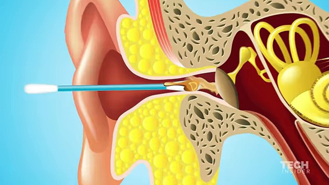 Foto - Kulak Çöpü: Masum Temizlik Aracından Tehlikeli Alışkanlığa!