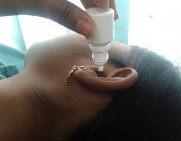 Foto - Kulak çubuğundaki büyük tehlike!