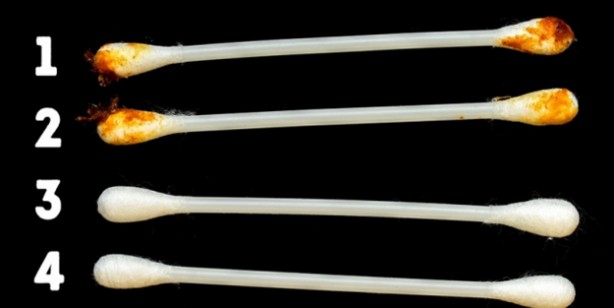 Foto - Kulak kiri sağlığımızın durumunu söylüyor: Kulakta ağrı ve tıkanma hissi varsa dikkat! İlaçlar onun kadar bile olamadı