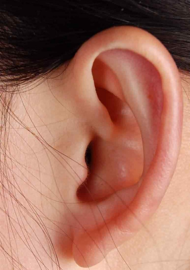 Foto - Kulak memesindeki çizgiye dikkat!