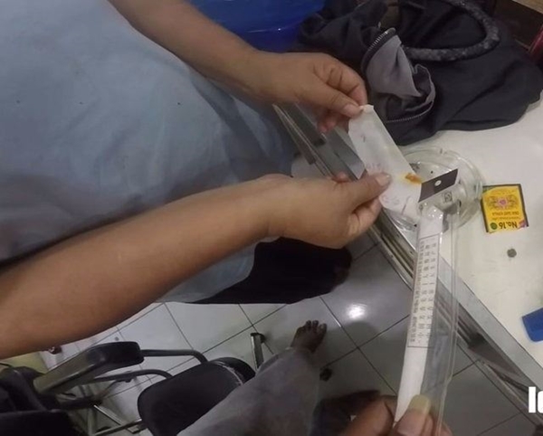 Foto - Kulak temizlemek için sıra dışı yöntem