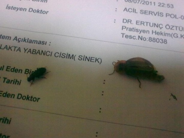 Foto - Kulaktan çıkanlar görenleri şok etti!