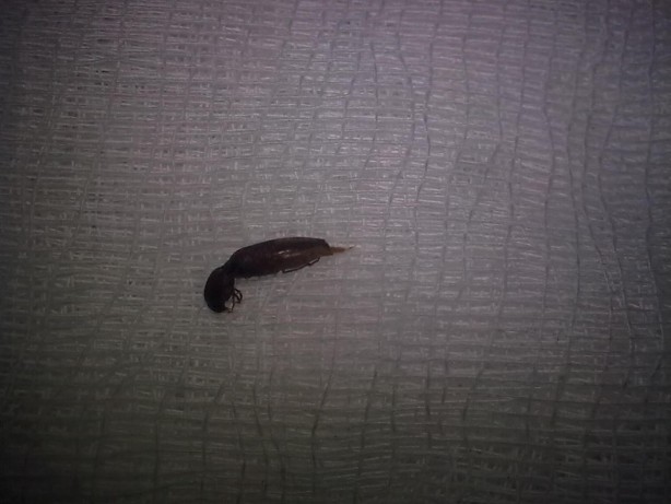 Foto - Kulaktan çıkanlar görenleri şok etti!