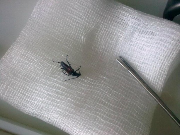 Foto - Kulaktan çıkanlar görenleri şok etti!