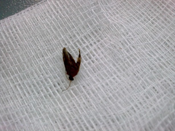 Foto - Kulaktan çıkanlar görenleri şok etti!