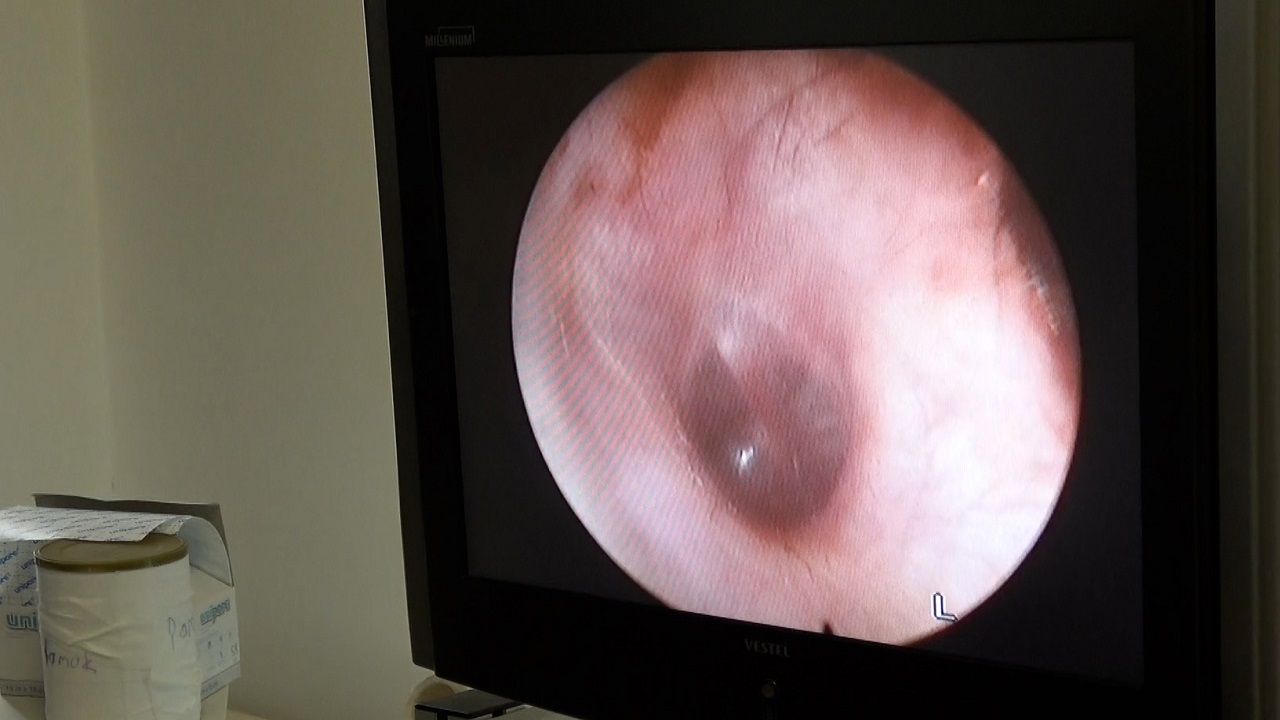 Foto - Kullanımı çok yaygın! 2050'de 2,5 milyar kişi işitme kaybıyla karşılaşabilir!