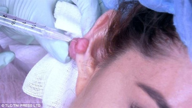 Foto - Küpe yüzünden az kalsın kulaklarından olacaktı