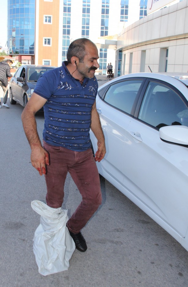 Foto - Kurban Bayramı'nın ilk acemi kasapları haberi geldi! Kimi elini, kimi kolunu kimi ise bacağını...