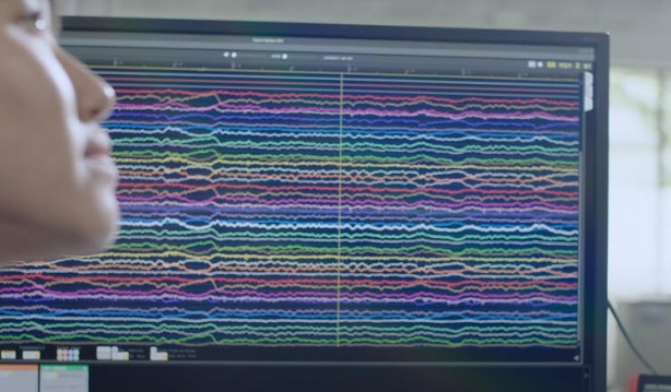 Foto - Küreselciler insanlığı robotlaştırmak için iş başında! Ve Elon Musk çipi tanıttı