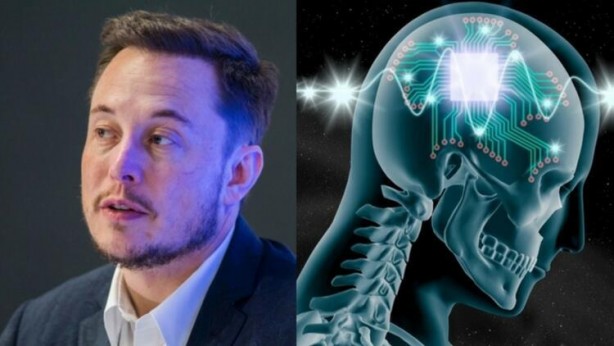 Foto - Küreselciler insanlığı robotlaştırmak için iş başında! Ve Elon Musk çipi tanıttı