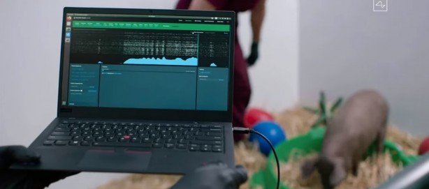 Foto - Küreselciler insanlığı robotlaştırmak için iş başında! Ve Elon Musk çipi tanıttı