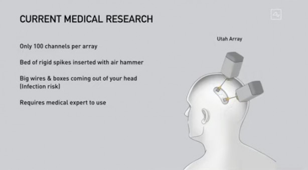 Foto - Küreselciler insanlığı robotlaştırmak için iş başında! Ve Elon Musk çipi tanıttı