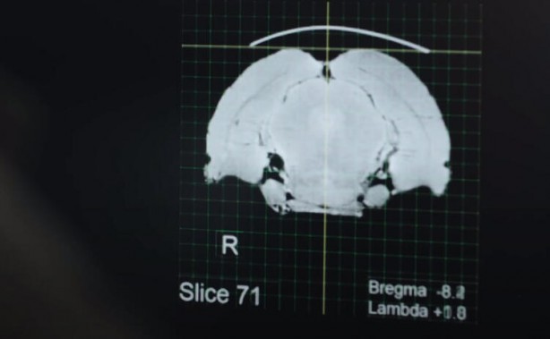 Foto - Küreselciler insanlığı robotlaştırmak için iş başında! Ve Elon Musk çipi tanıttı