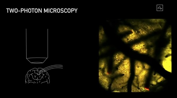 Foto - Küreselciler insanlığı robotlaştırmak için iş başında! Ve Elon Musk çipi tanıttı