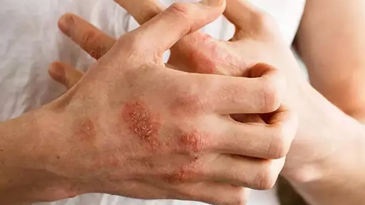 Kuru dutun faydaları: Osmanlı döneminde ilaç olarak kullanıldı! En güçlü kaynak, kansere düşman