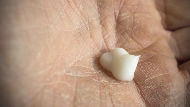 Foto - Kuru ve çatlak eller için evde uygulayabileceğiniz 5 yöntem