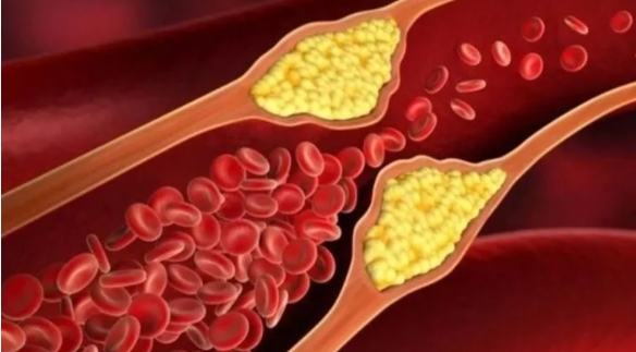 Foto - Lakabı yeşil altın! Faydaları inanılmaz