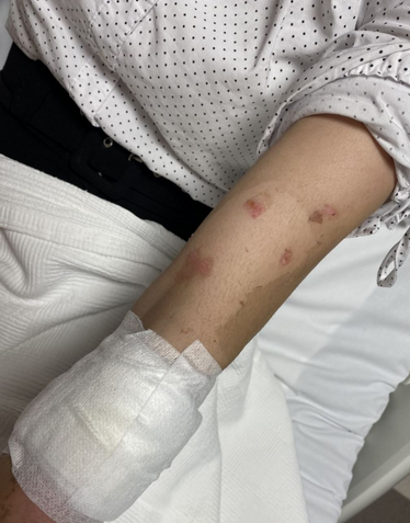 Foto - Lavabo açıcı! Uzman isim: 1. Dünya savaşında resmen Almanlar Fransızlara karşı kullandı deyip neden patlıyor açıkladı