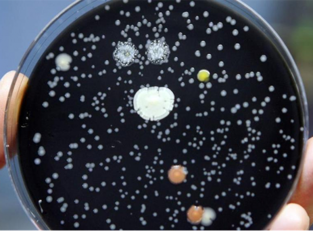 Foto - Lejyonella bakterisi nedir? Bu seferki çok fena, can alıyor! Hastaneden salgın iddiası gündem oldu: İçme suyundan bulaşıyor