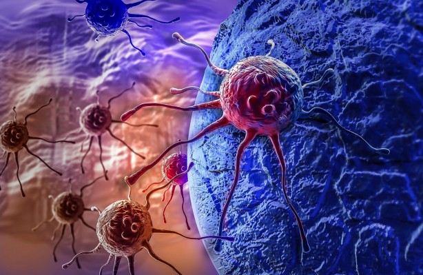 Foto - Lenfomayı işaret eden 10 yaygın belirti