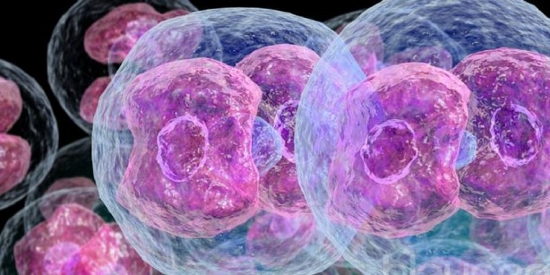 Foto - Lenfomayı işaret eden 10 yaygın belirti