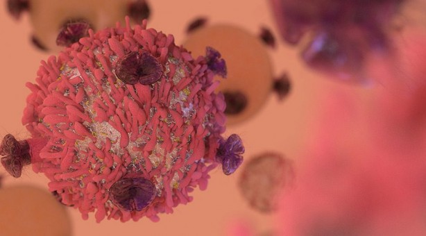 Foto - Lenfomayı işaret eden 10 yaygın belirti