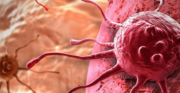 Foto - Lenfomayı işaret eden 10 yaygın belirti