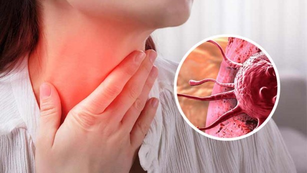 Foto - Lenfomayı işaret eden 10 yaygın belirti