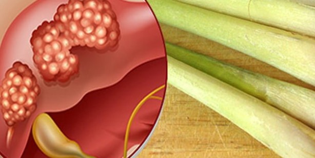 Limon otu özü kanser hücrelerini öldürüyor ortaya çıktı! Uzman isimler açıkladı: Antioksidan, iyi geliyor!