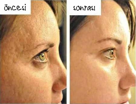 Foto - Limon sıradan bir meyve değil, içinde 7 sır var: Bakın nasıl! Kullanınca ne oluyor? Limonun farklı kullanım alanı