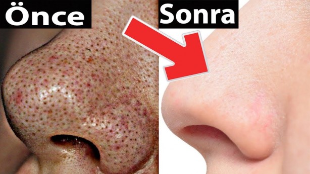 Foto - Limon sıradan bir meyve değil, içinde 7 sır var: Bakın nasıl! Kullanınca ne oluyor? Limonun farklı kullanım alanı