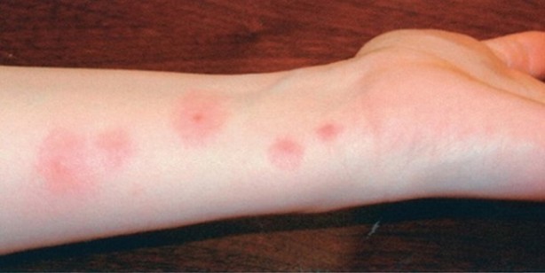 Foto - Limon yağının faydaları nelerdir? Limon yağı ne işe yarar? Neye iyi gelir?