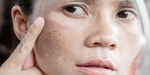 Foto - Limon yağının faydaları nelerdir? Limon yağı ne işe yarar? Neye iyi gelir?