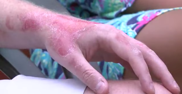 Foto - Limonata yaparken dikkat etmezseniz sonunuz böyle olabilir!