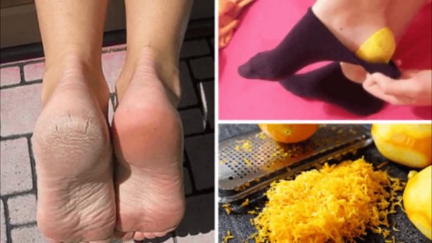 Limonu ayağınızın altına sürerseniz bakın ne oluyor