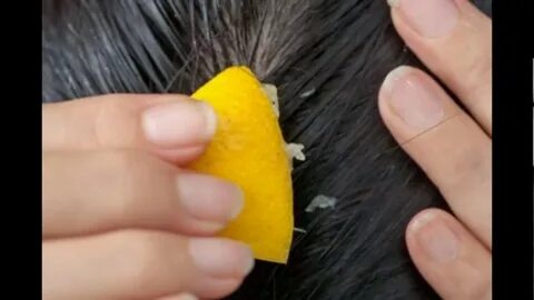 Foto - Limonu ayağınızın altına sürerseniz bakın ne oluyor