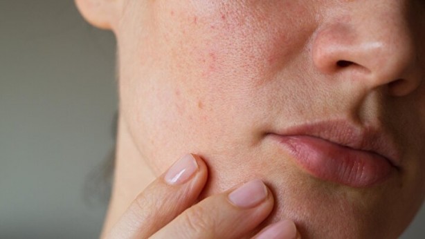 Foto - Limonu ayağınızın altına sürerseniz bakın ne oluyor