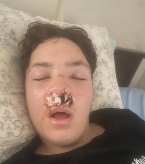 Foto - Lise çıkışında kanlı kavga