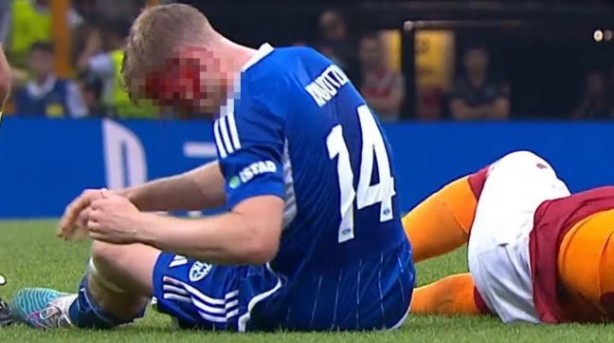 Foto - Maçta korku dolu anlar! Icardi'yi durdurmaya çalışırken olanlar oldu