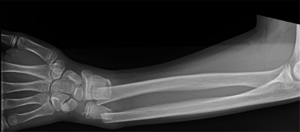 Foto - Maden suyunu bardakta içmeyin!